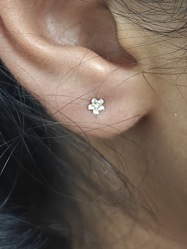 Today's painless ear piercing for a baby by dr CHAVAN KARTHIK post image