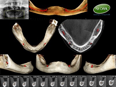 Photos of UMO | RX-ORAL Radiolog&iacute;a y Tomograf&iacute;a 3D