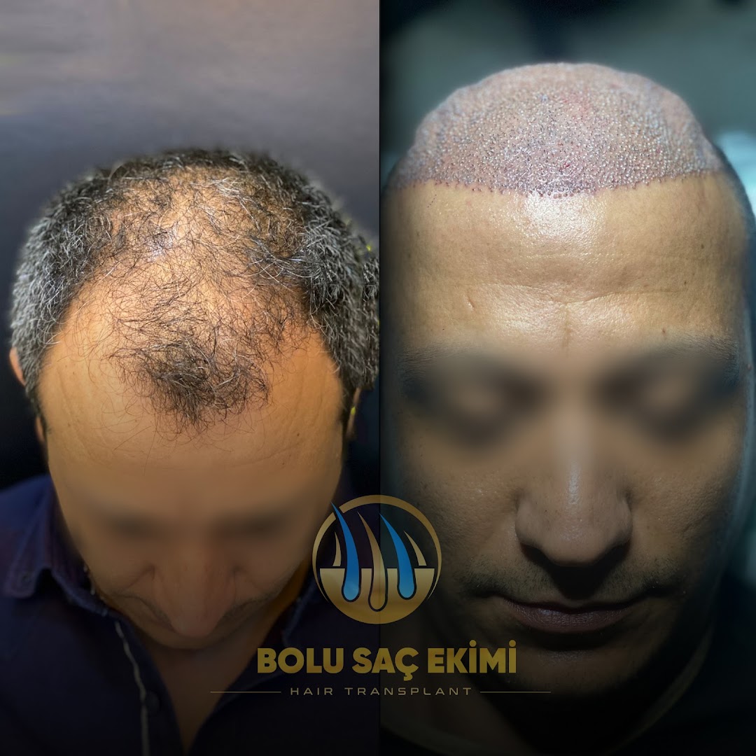 Bolu Saç Ekimi Merkezi clinic 3