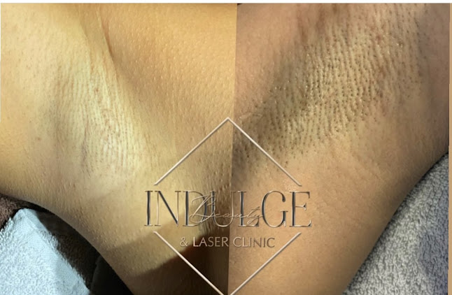 Comments and reviews of Indulge Beauty & Laser Clinic