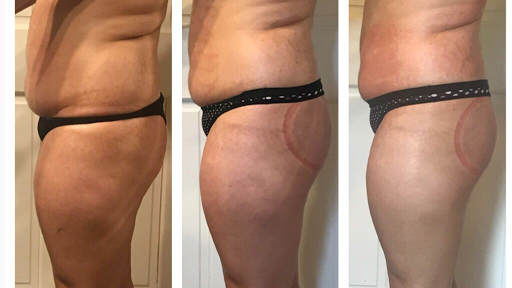 Karin Slimming Massage only for women - United States
