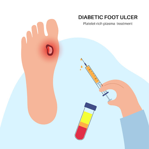 At TruCare Clinic and Diagnostics in Bangalore, patients receive comprehensive support for diabet… post image