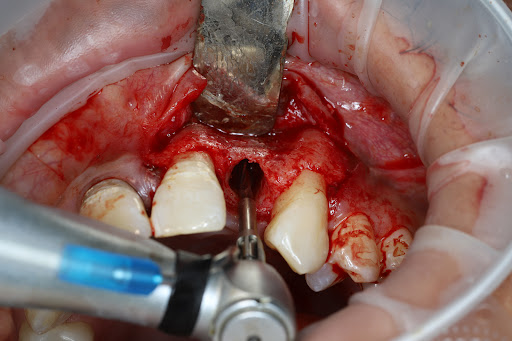 Nicholson Road Dental Centre - Dr Hossam Ismail - Thumbnail
