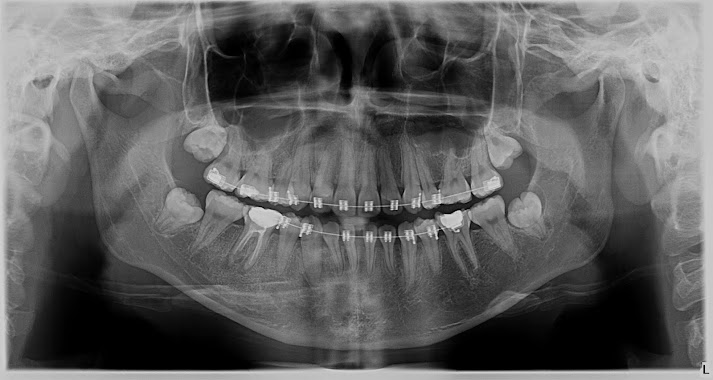 Diagnóstico Dental, Author: Diagnostico Dental