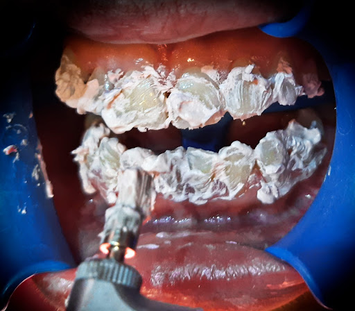 Consultorio Dental DentoFamily Izúcar - Thumbnail