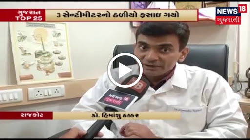 અન્નનળી માં ફસાયેલ ૩ સેન્ટી મોટો અને ધારદાર ઠળિયો દૂરબીન વડે કાઢી આપતા ડો હિમાંશુ ઠક્કર ઈએનટી સર્… post image