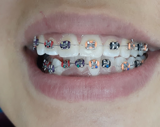 Kapi dental - Visual