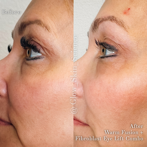 Glow Skin Science