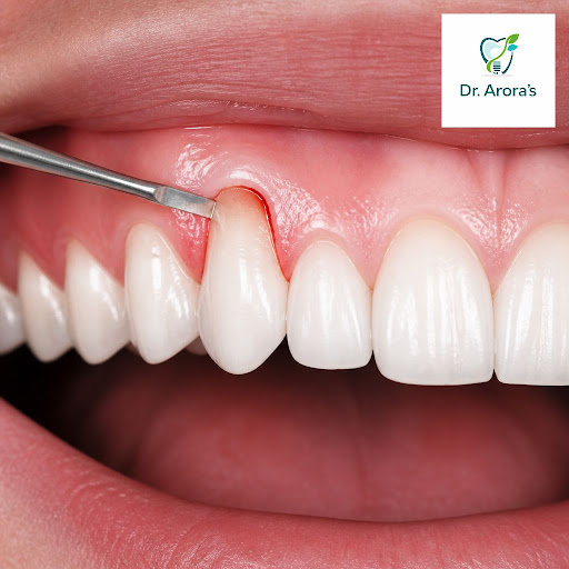 Dreaming of a more attractive smile and healthier gums? At Dr. Arora's Multispeciality Dental Cli… post image