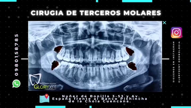 Comentarios y opiniones de Glorydent Odontologia Integral