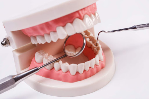 A dental check-up is a routine appointment with a dentist or dental hygienist to assess your oral…
