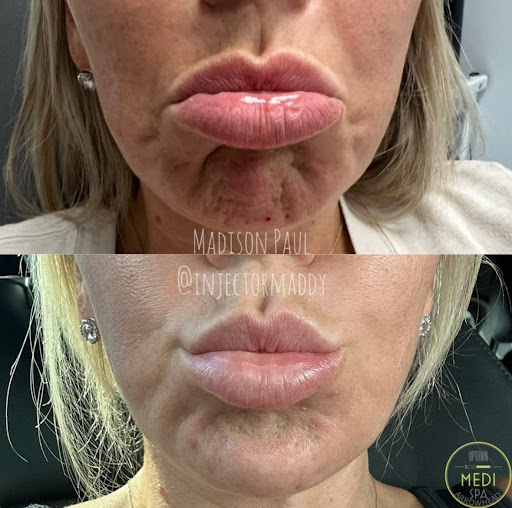 Uptown Medispa Arrowhead