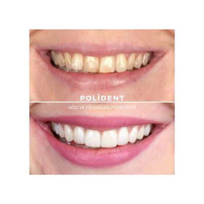 Polident Dental Clinic