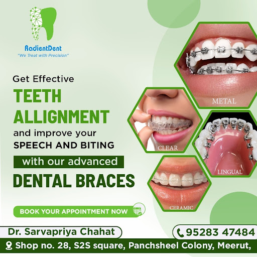 Get effective teeth alignment and improve your speech and biting with our advanced dental braces… post image