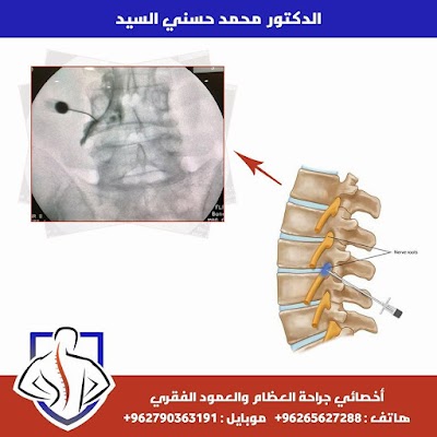 Photos of عيادة د. محمد السيد لجراحة العمود الفقري والعظام والمفاصل