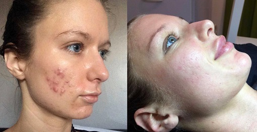 Advanced Skin Care Solutions
