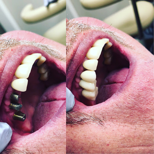 Troy smiles: Cosmetic and Implant Dentistry