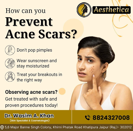 🌟 Prevent Acne Scars & Get Smooth, Clear Skin! 🌟