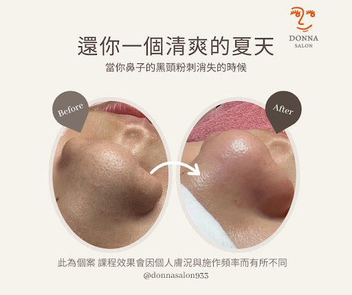 Donna Salon肌膚管理-中山會館評價、營業時間、服務項目、價格 – 專業無痛清粉刺與肌膚管理 - Place thumbnail