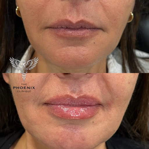 The Phoenix Clinique