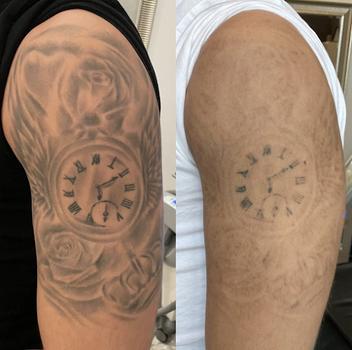 Comentarii opinii despre Nudecph