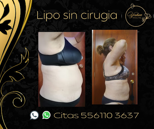 Yeshua Spa Roberto - Thumbnail