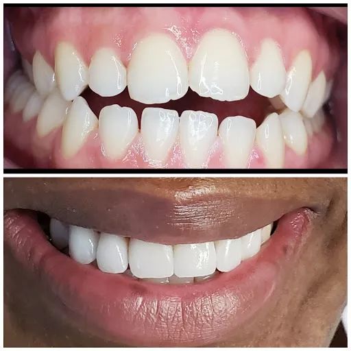 Long Falls Dentistry Gallery - United States