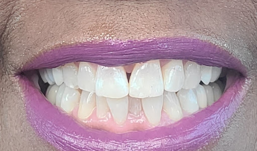 Atlas Grand Dental - Thumbnail