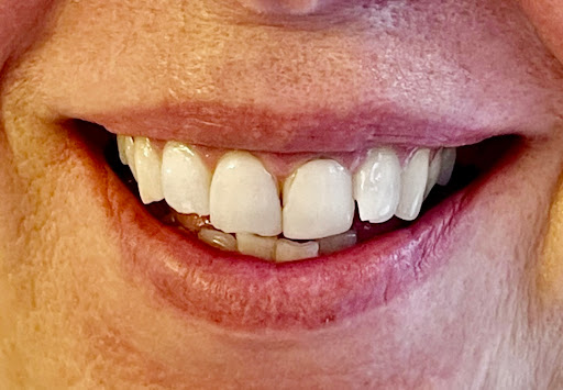 Smileology UK - Thumbnail