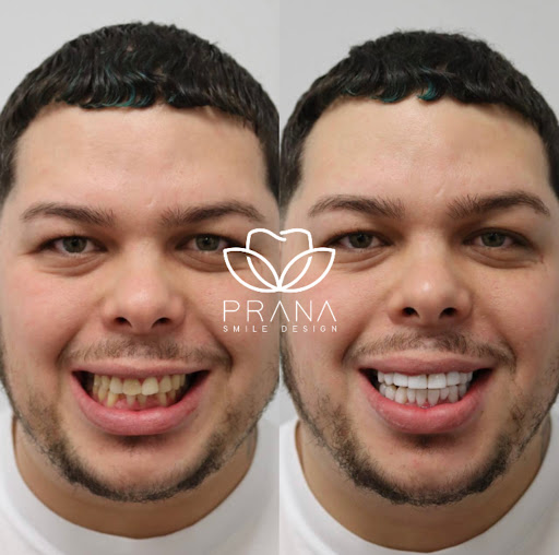 Prana Smile Design - Thumbnail