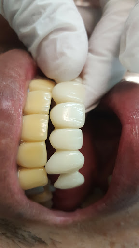 Odontotab - Visual