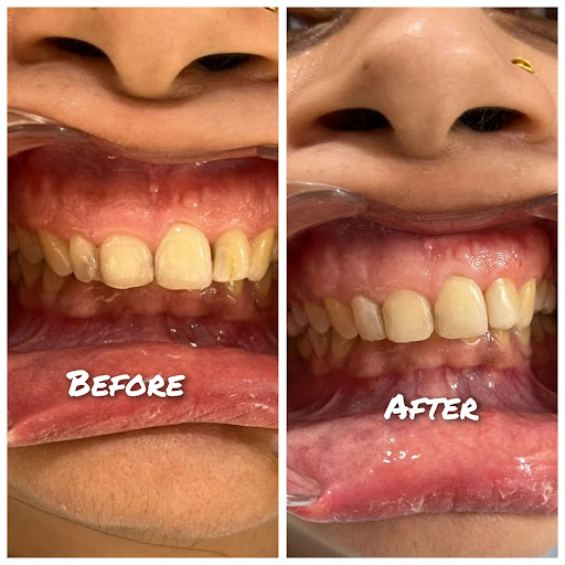 Daily habits, food choices, and busy schedules often affect dental health without obvious warning…