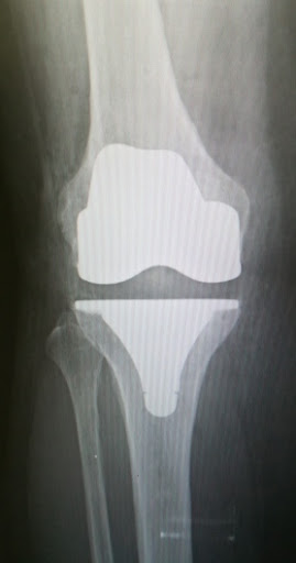 Dr. Gennaro Campopiano, Ortopedico - Thumbnail
