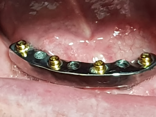 TECNODENTAL di Montagnoli Fabio LAB.PROTESI DENTALE - Thumbnail