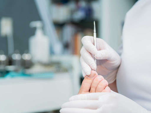 Medisch Pedicure Hoorn - Karin Harzing - Thumbnail