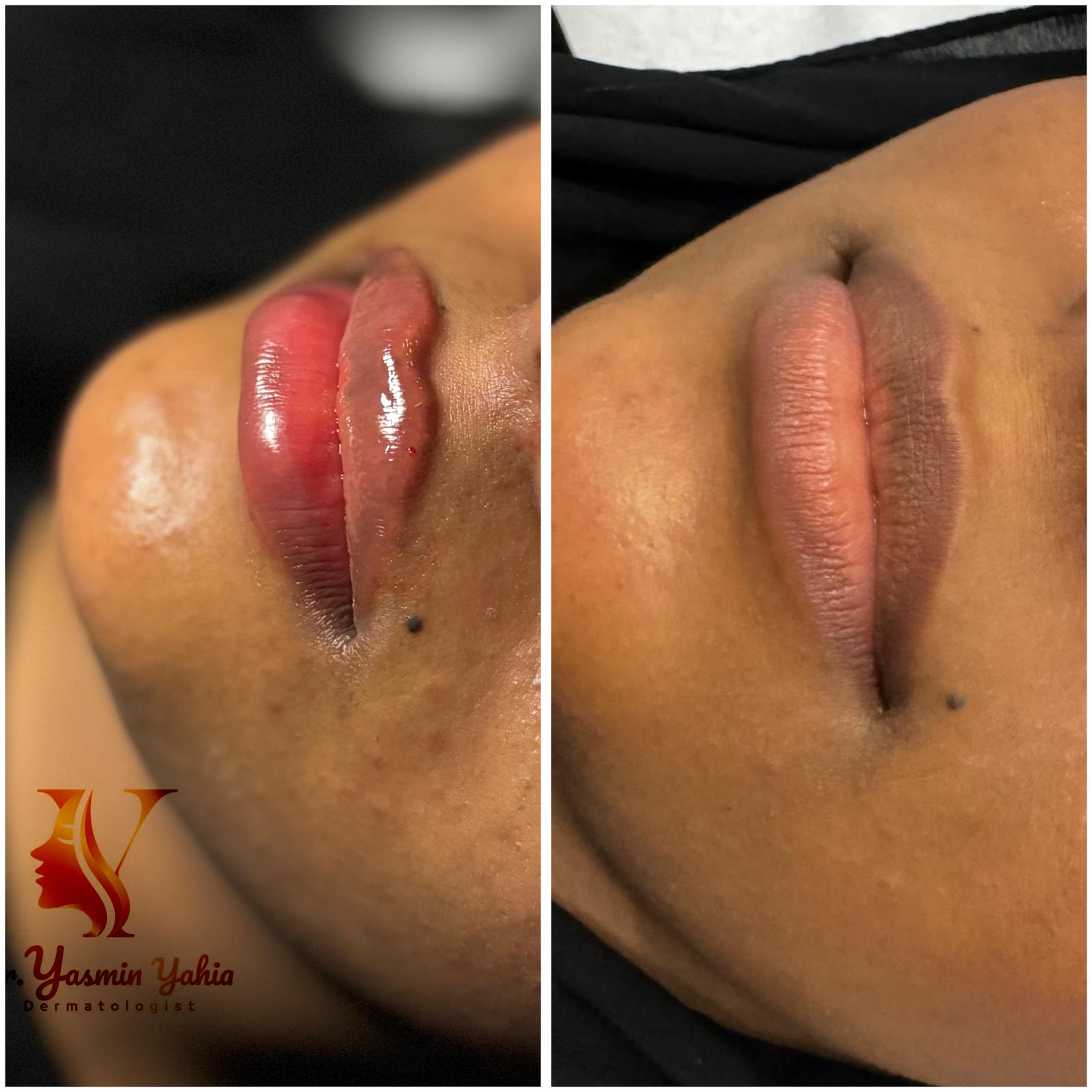 الدكتورة ياسمين السيد جلدية و تجميل - صورة 2