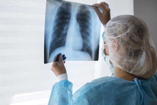 Bronchoscopy is a minimally invasive procedure used to diagnose and treat conditions affecting th… post image
