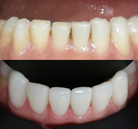 Photo n°19 de Docteur Zine Idrissi à Aix-en-Provence (Service de blanchiment des dents)