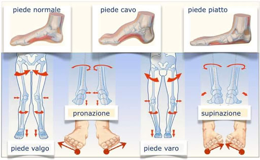 PLANTARI SU MISURA PADOVA - Thumbnail