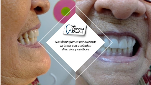 Torres Dental - Thumbnail