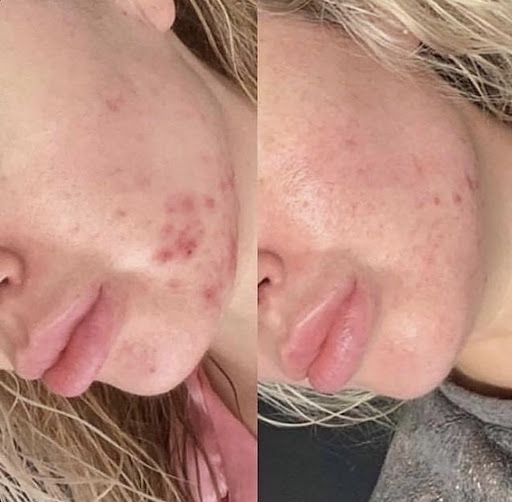 Precision Face and Body Clinic