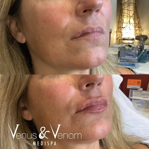 Venus & Venom MEDIspa Monroe - Thumbnail