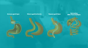 Photo n°3 de Dr Zouhair BENJELLOUN à Saint-Étienne (Chirurgien oncologique)