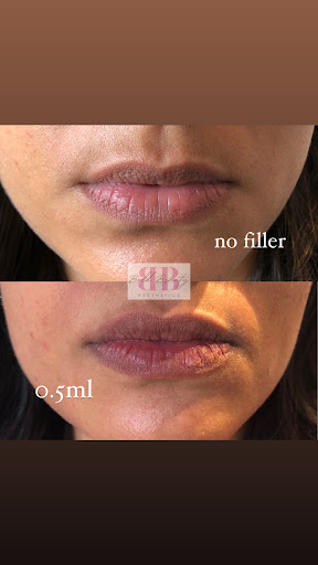 Bold Beauty Aesthetics - Thumbnail