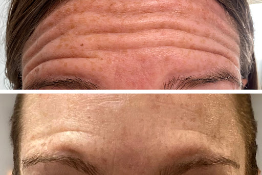 Evoke Aesthetics Shepparton - Thumbnail