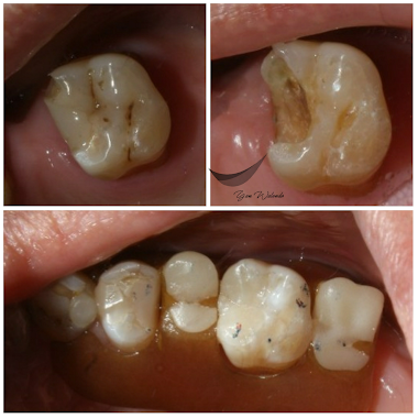 Drg Yan Walando (Glam Dental Studio), Author: Drg Yan Walando (Glam Dental Studio)