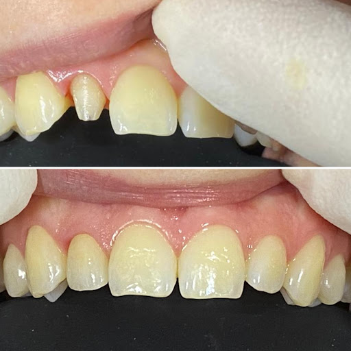 Studio Dentistico Dalla Corte & Forcellini - Thumbnail
