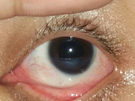 Cured within 14 days  (Dr Soumya Dey's Clinic desk)  post image