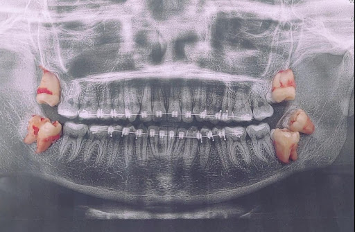 IMDENTAL - Visual