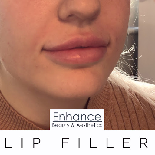 Enhance Clinic UK - Thumbnail
